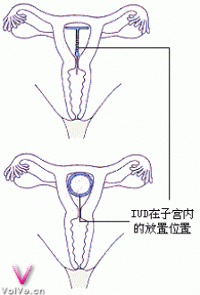 ϻܵӸǻ?_ޱʱ