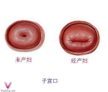 Ůӹṹ_ޱʱ